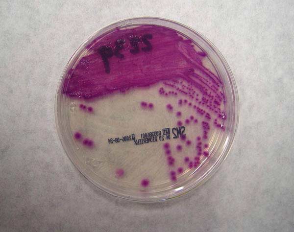 8. Placa Petri salmonella